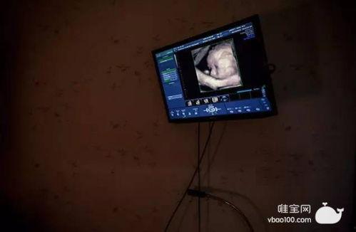 美国产房生子视频,见证新生命的诞生瞬间  第2张